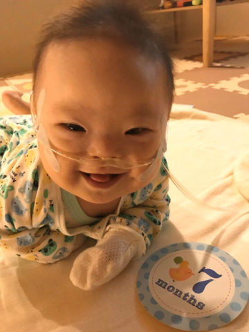 児童発達支援